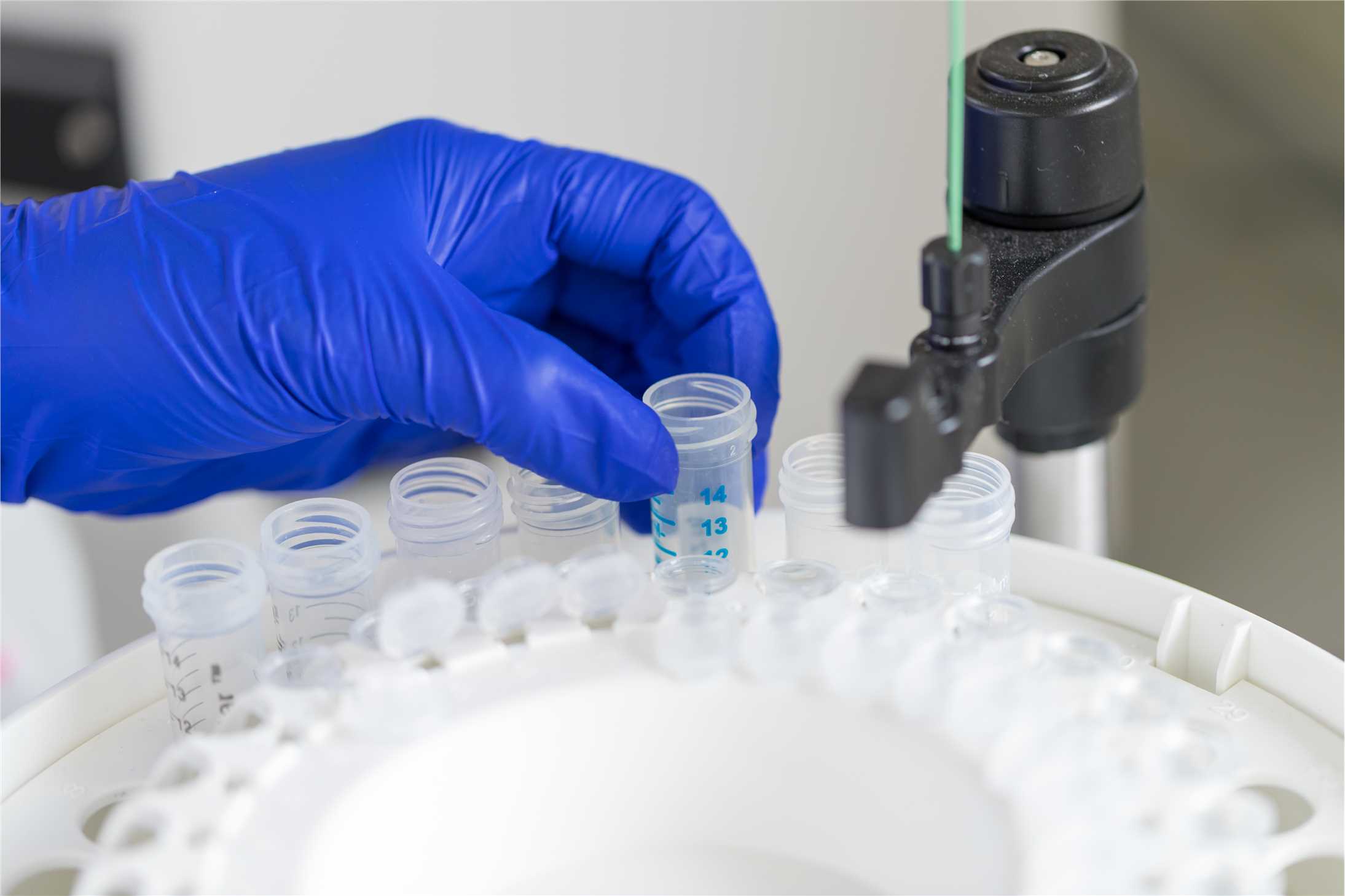 Precipitation and centrifugation. (Creative Biolabs Original)