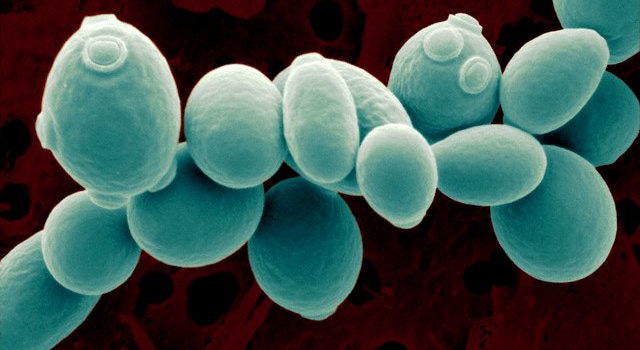 Saccharomyces Cerevisiae S Cerevisiae Cell Lines Creative Biolabs Saccharomyces Cerevisiae S Cerevisiae Cell Lines Creative Biolabs